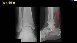 Anatomía Rx Tobillo [upl. by Nidla552]