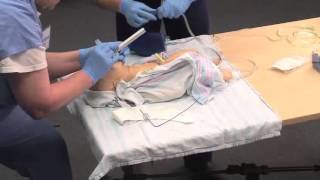 Using a Meconium Aspirator [upl. by Aitnahc]