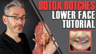 ADVANCED BOTOX ANATOMY How to avoid nasty lowerface side effects Aesthetics Mastery Show [upl. by Enyleve]