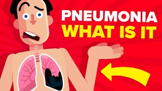 Pneumonia  Explained [upl. by Fellows148]