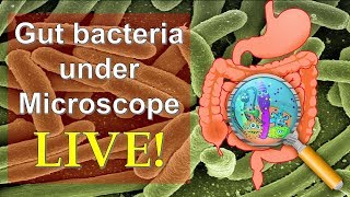 E Coli Bacteria Microbiology  Escherichia Coli  E Coli Disease [upl. by Libby]