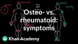 Osteoarthritis vs rheumatoid arthritis symptoms  NCLEXRN  Khan Academy [upl. by Nnyroc]