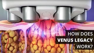 How Does Venus Legacy™ Work [upl. by Natye316]