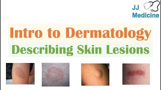 Introduction to Dermatology  The Basics  Describing Skin Lesions Primary amp Secondary Morphology [upl. by Remmos]