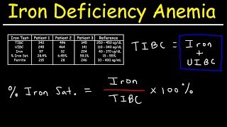 Iron Deficiency Anemia  TIBC UIBC Iron Saturation Transferrin amp Ferritin [upl. by Alleira161]