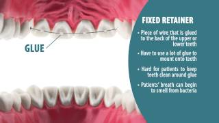 Types of Retainers  Retainer Wear Part 2 [upl. by Niarfe]