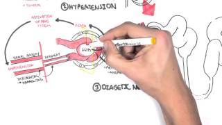 Chronic Kidney Disease CKD Pathophysiology [upl. by Drofhsa]