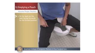 ColostomyIleostomy Emptying a Pouch [upl. by Anialem394]