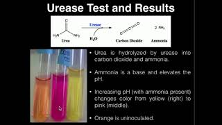 Microbiology Urea Test [upl. by Huldah]