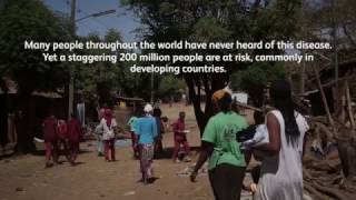 The Community Impact of Trachoma [upl. by Nospmis335]