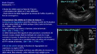 insuffisance mitrale [upl. by Eedebez733]