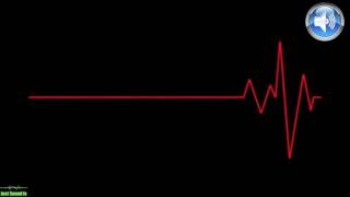 Heartbeat Sound Effect Normal to Slow I Heartbeat Slowing down Sound Effect 1 [upl. by Cornelle]