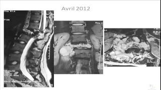 RADT 101 Image Formation and Radiographic Quality [upl. by Fallon]