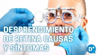 Causas y síntomas del desprendimiento de retina [upl. by Noreht]