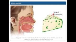 Diarrea Secretoria [upl. by Cathey]
