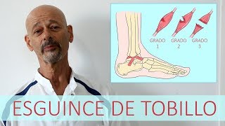 ESGUINCE DE TOBILLO  Lesión de ligamentos [upl. by Dosia322]