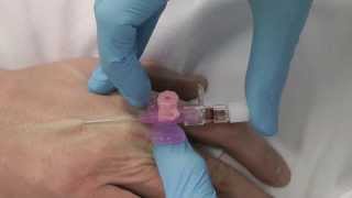 Cannulation How to gain IV access [upl. by Puklich]