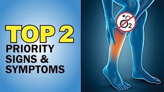 PAD Peripheral arterial disease 2 MOST important signs amp symptoms on Exams amp NCLEX [upl. by Naot]