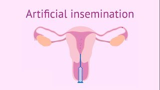 Artificial insemination [upl. by Nikolaus744]