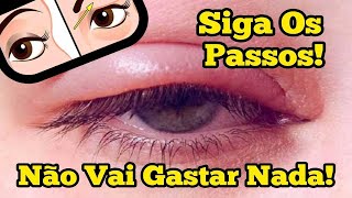 Pálpebras Inchadas Como Tratar Exercícios Caseiros Para Desinchar As Palpebras Rápido [upl. by Adav66]