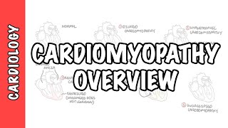 Restrictive cardiomyopathy Pathophysiology and diagnosis  NCLEXRN  Khan Academy [upl. by Notgnillew]