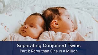 Separating Conjoined Twins Part 1 Rarer than One in a Million [upl. by Adnohsirk495]