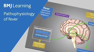 Pathophysiology of fever explained [upl. by Kauslick137]