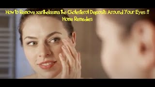 How to Remove xanthelasma the Cholesterol Deposits Around Your Eyes  Home Remedies [upl. by Bordy]