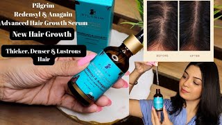 Get Thicker Denser amp Lustrous Hair With PILGRIMS REDENSYL amp ANAGAIN HAIR GROWTH SERUM [upl. by Airel745]