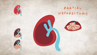 Kidney Donation And Transplant Requirements  Piedmont Healthcare [upl. by Nanaj885]