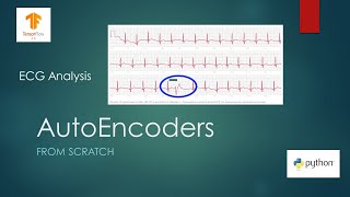 Anomaly Detection with AutoEncoders using Tensorflow [upl. by Enneyehc]