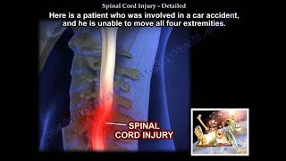 Spinal Cord Injury Detailed  Everything You Need To Know  Dr Nabil Ebraheim [upl. by Atihana]