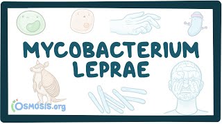 Nontuberculous Mycobacterial Lung Disease Today and Tomorrow [upl. by Burty944]