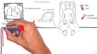 Acute Coronary Syndrome DETAILED Overview MI STEMI NSTEMI [upl. by Nahraf]