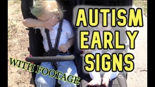 AUTISM EARLY SIGNS  Two Years Old Incl Footage [upl. by Wylde]