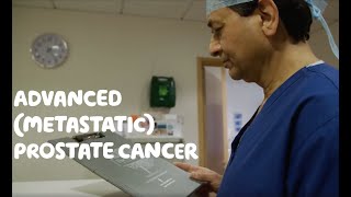 About Advanced Metastatic Prostate Cancer [upl. by Filberte]