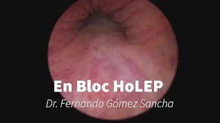 En Bloc HoLEP with early apical liberation [upl. by Baudin]