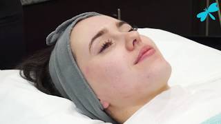 Medical Microneedling Treatment  The Laser and Skin Clinic [upl. by Jaan528]