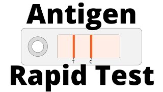 How SARSCoV2 Antigen Rapid Tests work Covid19 Testing [upl. by Nnaytsirk]