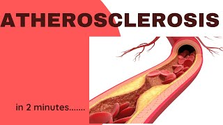 Atherosclerosis in 2 minutes [upl. by Nesbitt235]