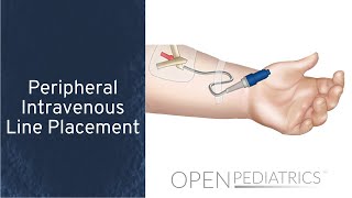 Peripheral Intravenous Line Placement by B Johnson L DelSignore  OPENPediatrics [upl. by Ronny]