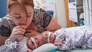 Conjoined babies abandoned by drug addict mum  60 Minutes Australia [upl. by Ettelimay]