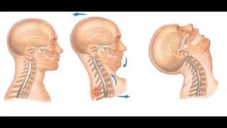 ESGUINCE CERVICAL SÍNTOMAS  GRADOS DE ESGUINCE CERVICAL  TRATAMIENTO PARA ESGUINCE CERVICAL [upl. by Wilbert459]