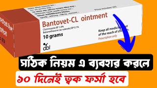 Bantovet CL Ointment ব্যবহারের সঠিক নিয়ম ১০ দিনে ত্বক ফর্সা হবে 😱 Bantovet CL Ointment Use On Face [upl. by Tat]