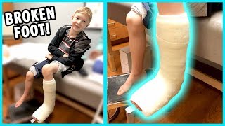 Getting a Cast Jacob Broke His Foot  Part 2 [upl. by Hawthorn]