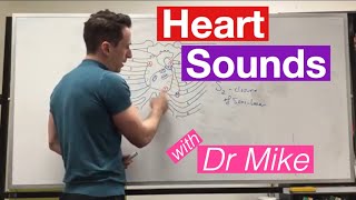 Adventitious Lung Sounds Medical Definition [upl. by Dov643]