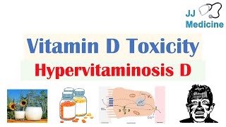 Vitamin D Toxicity Hypervitaminosis D  Causes Pathophysiology Symptoms Diagnosis Treatment [upl. by Rebmyk]