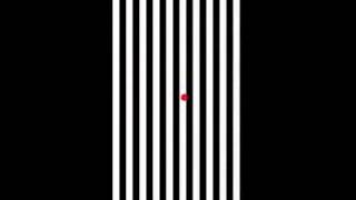 Modified Optokinetic [upl. by Hay]