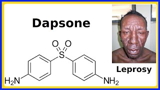 Examining Bartonella [upl. by France]