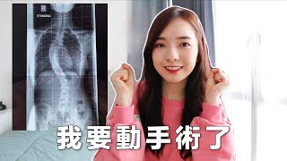 【脊椎側彎】我決定動手術了 Scoliosis Surgery ｜Stephy Yiwen [upl. by Aysahc]